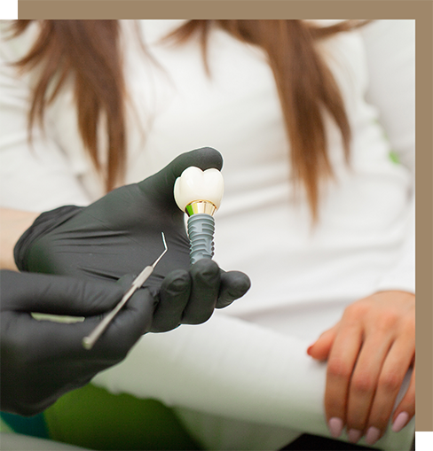 Dentist showing a dental implant to a patient
