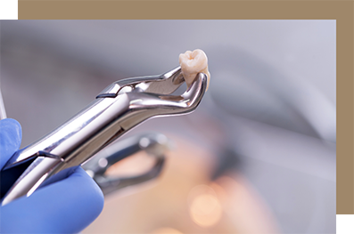 Dental forceps holding an extracted tooth