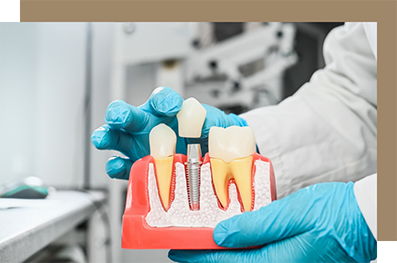 Placing a crown on a model of a dental implant
