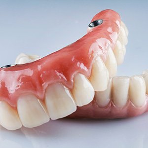 A full set of implant dentures